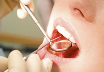 Instrumentos dentales para examinar una boca abierta con un espejo dental y una sonda.