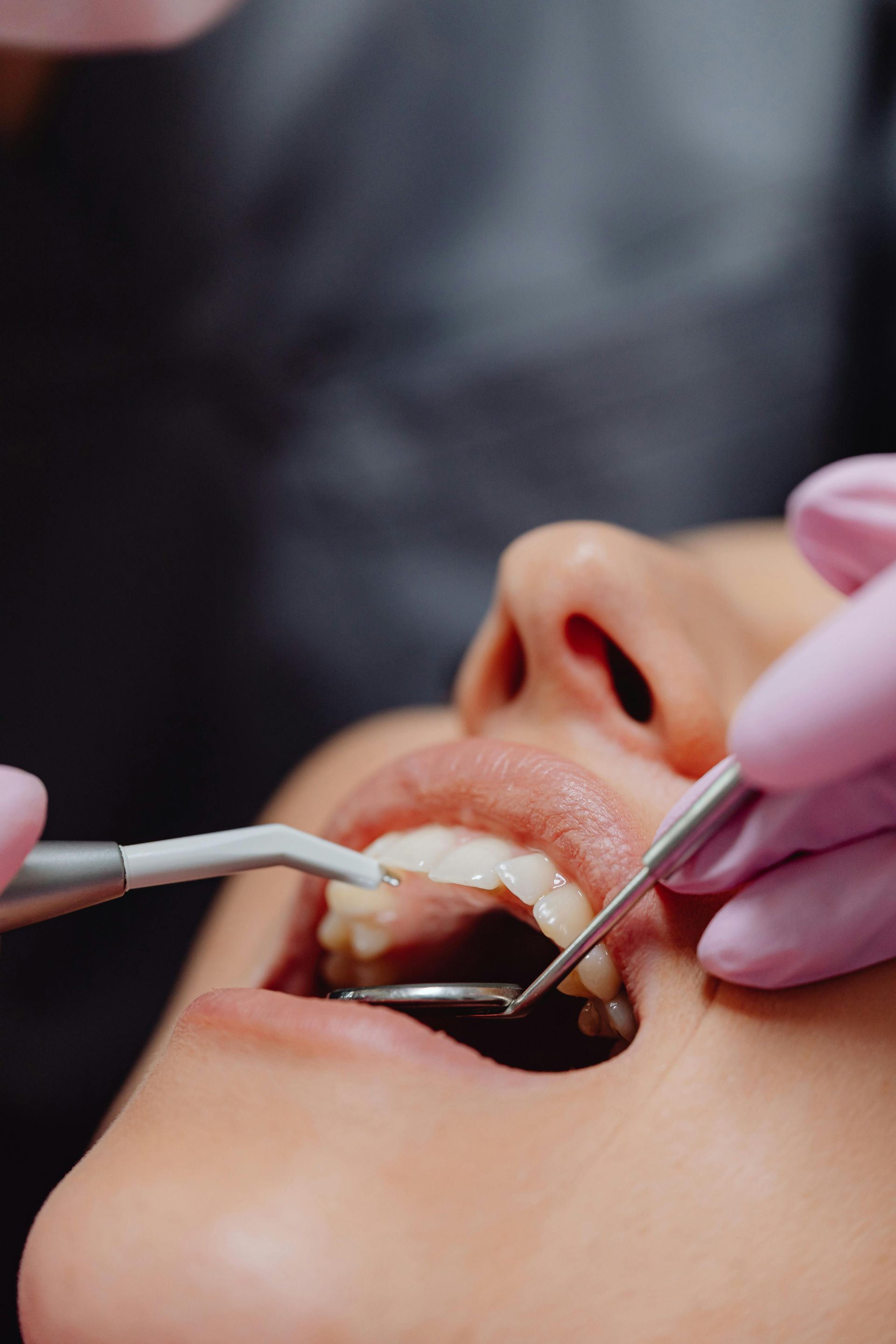 Odontólogo limpiando los dientes de un paciente con instrumental dental y manos enguantadas.