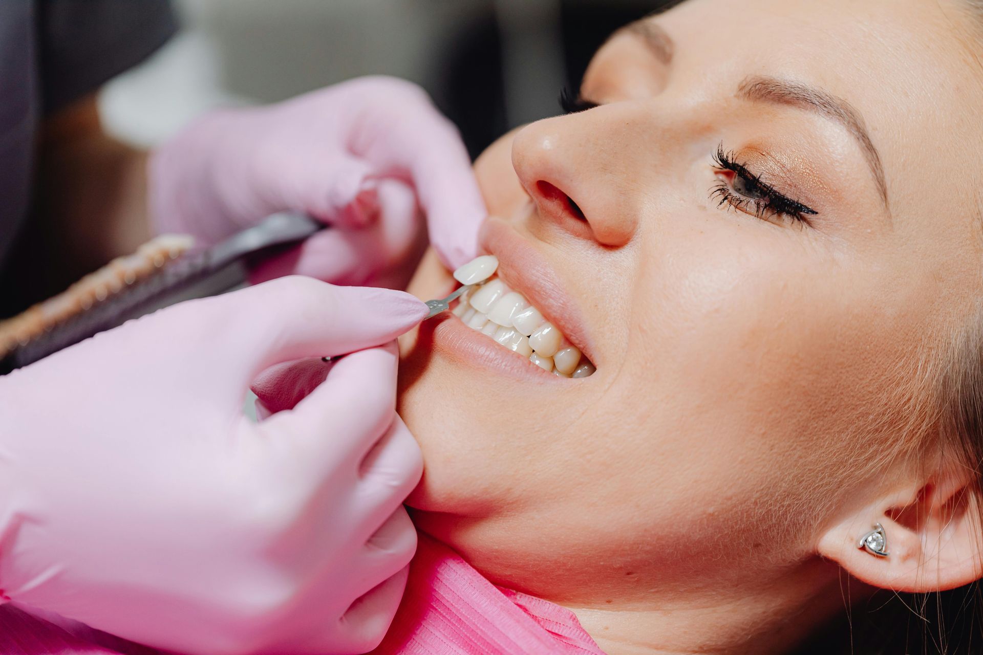Un dentista ajusta los aparatos de ortodoncia de una mujer con guantes rosas durante un procedimiento dental.