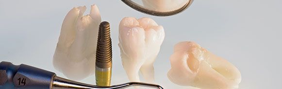 Implante dental y dos coronas dentales sobre fondo claro con espejo e instrumental dental.