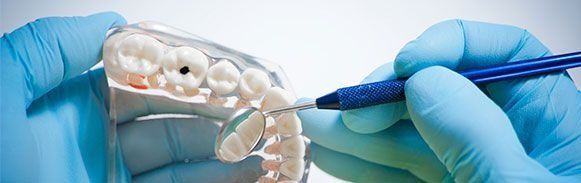 Dentista examinando un molde dental con instrumentos y guantes azules.