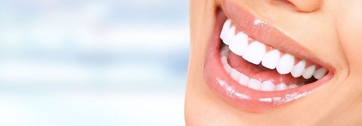 Un primer plano de la sonrisa de una mujer con dientes blancos.
