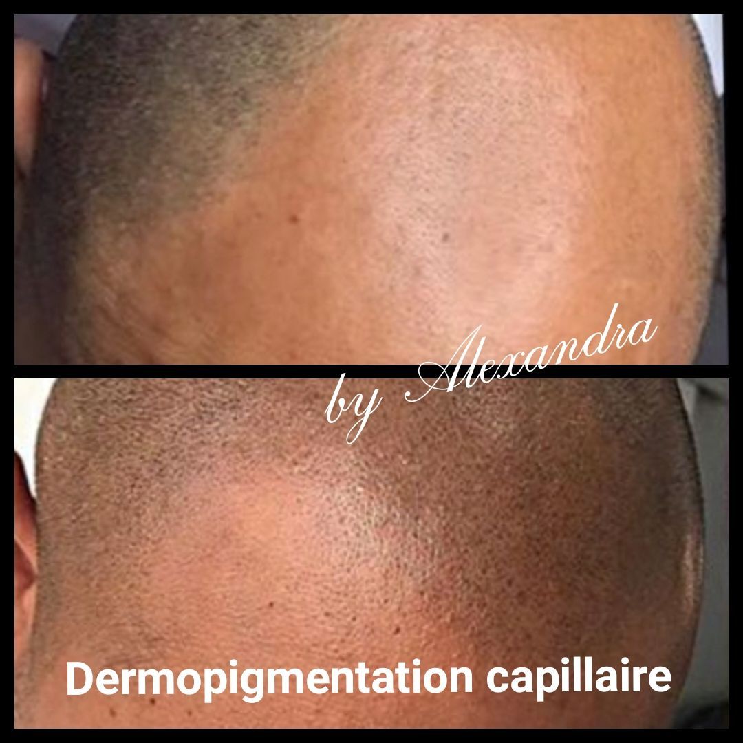 SCP homme avant/après séance à l'institut