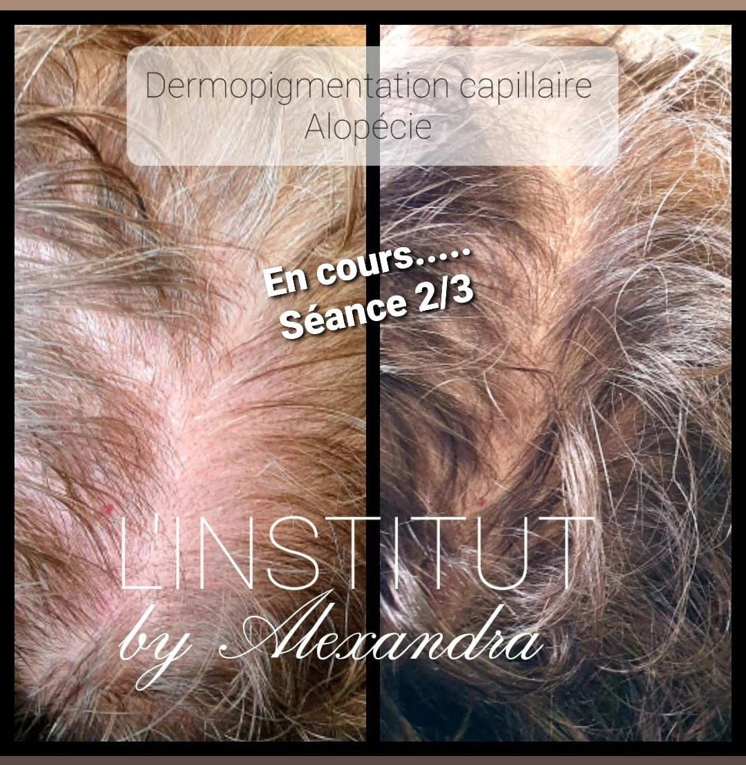 SMP femme, séance 2 et 3, avant/après