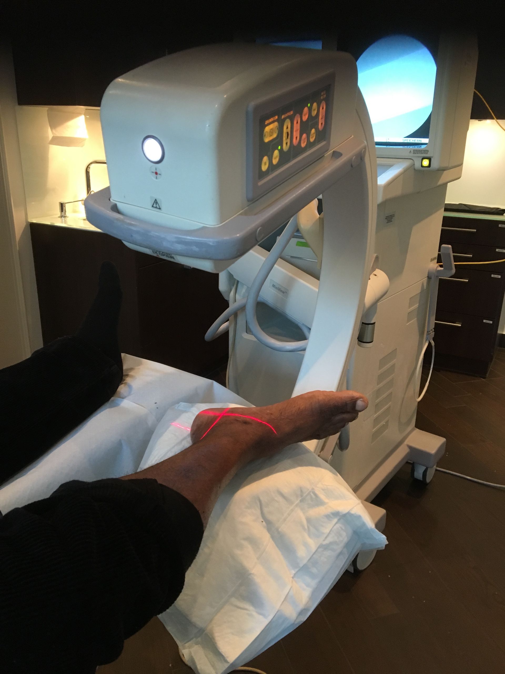 Fussröngen - Praxis für Fusschirurgie