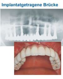 Dr. med. dent. J. Schneider