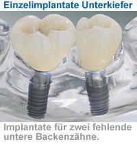 Dr. med. dent. J. Schneider