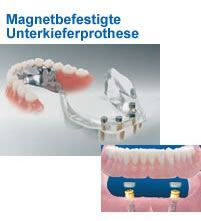 Dr. med. dent. J. Schneider