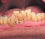 Dr. med. dent. J. Schneider