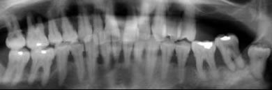 Dr. med. dent. J. Schneider