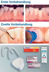 Dr. med. dent. J. Schneider