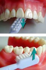 Dr. med. dent. J. Schneider