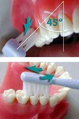 Dr. med. dent. J. Schneider