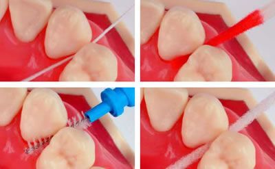 Dr. med. dent. J. Schneider