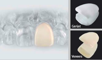 Dr. med. dent. J. Schneider