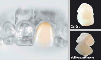 Dr. med. dent. J. Schneider