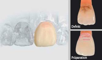 Dr. med. dent. J. Schneider