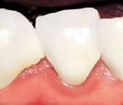 Dr. med. dent. J. Schneider