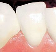 Dr. med. dent. J. Schneider