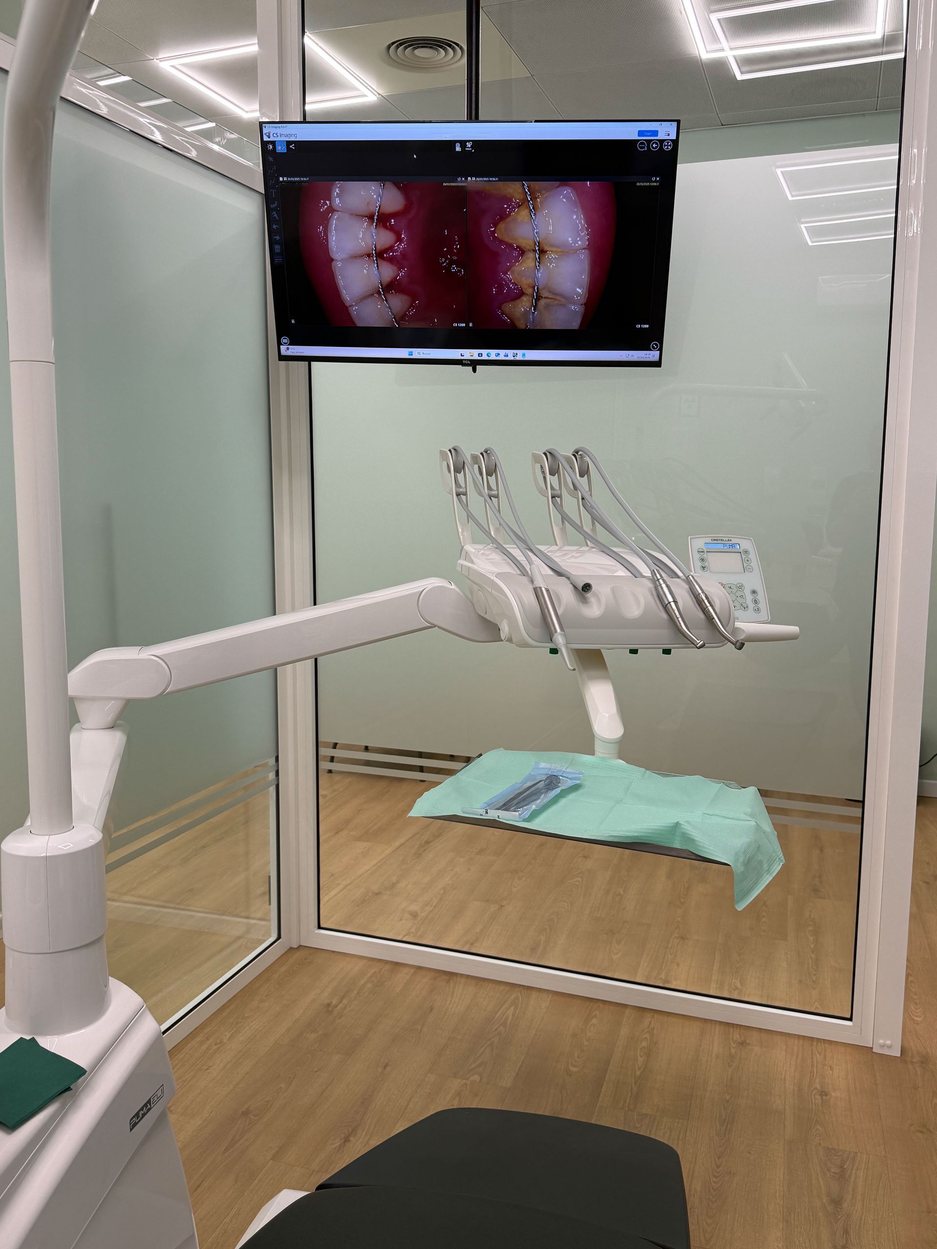 protesis dentales fijas