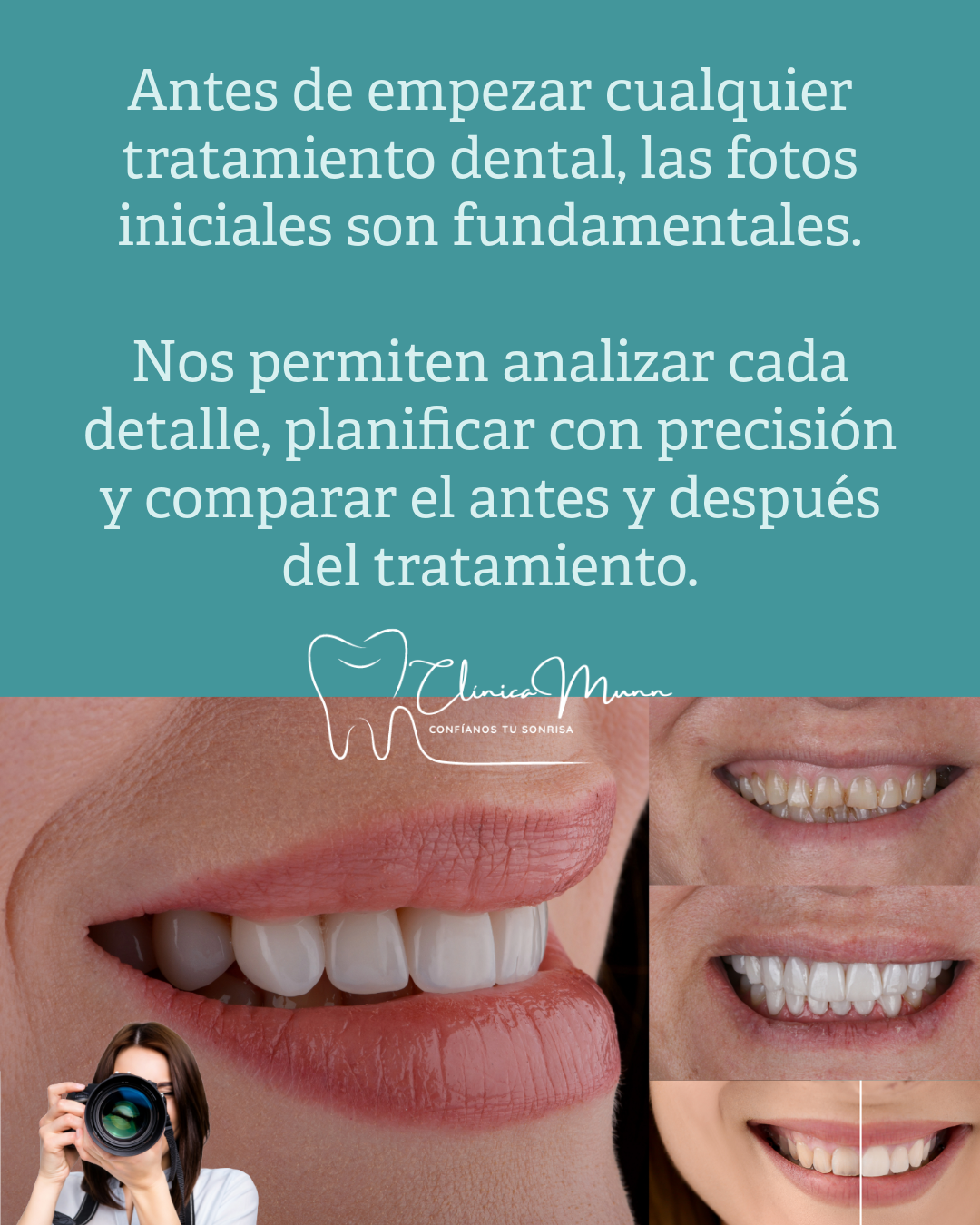 limpieza dental precio