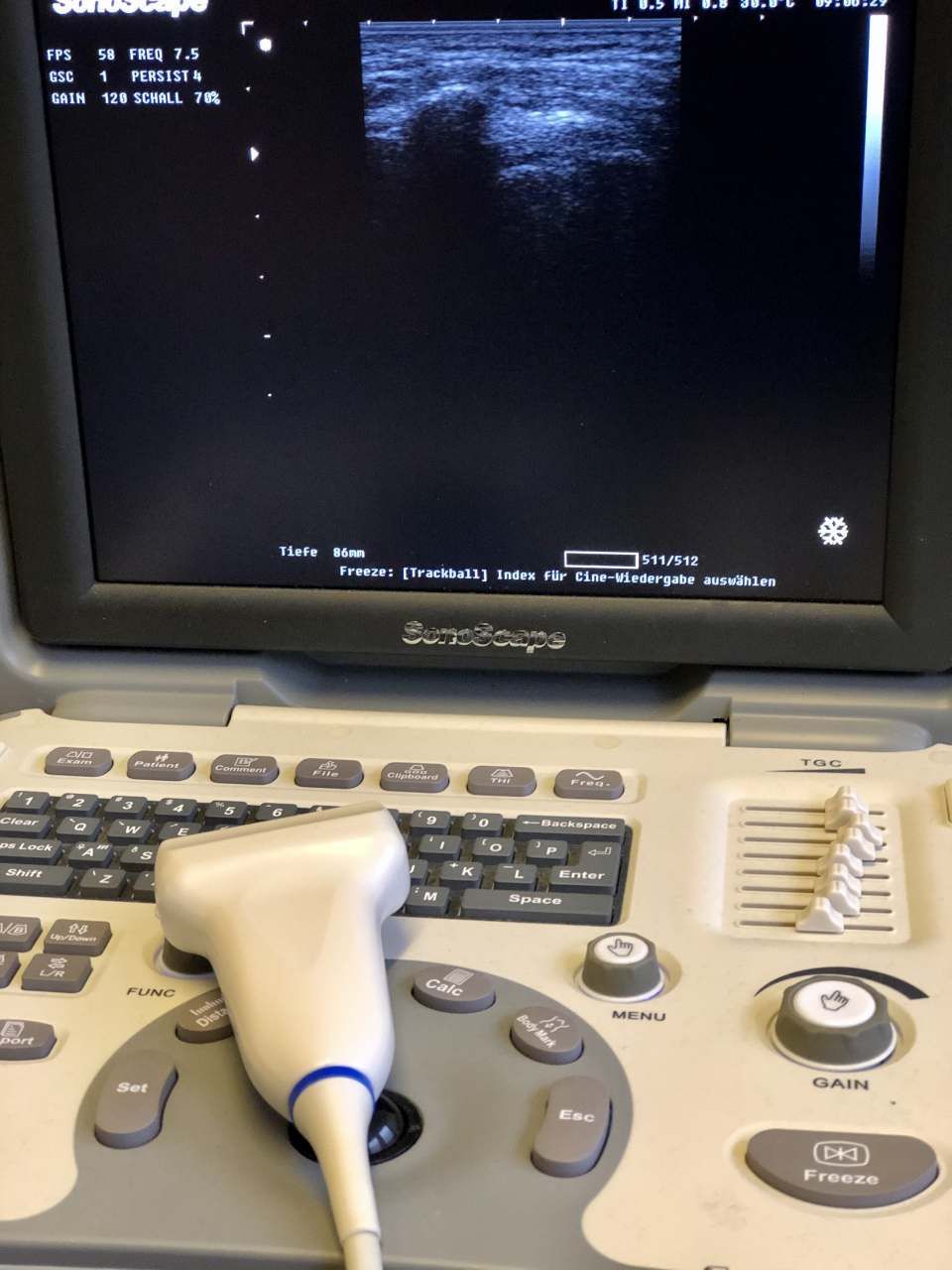 Ultraschalldiagnose