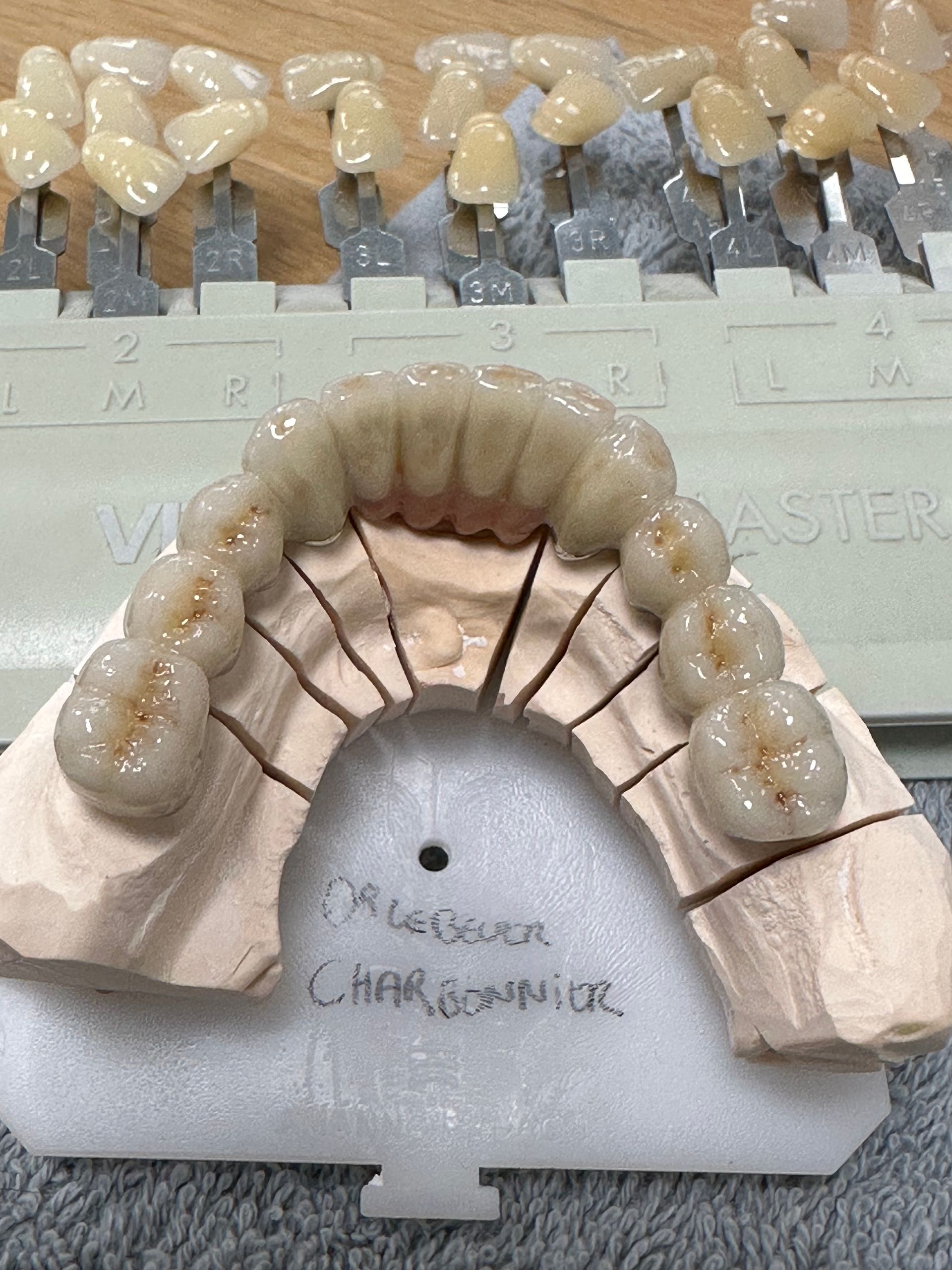 Réalisation sur mesure de prothèse dentaire