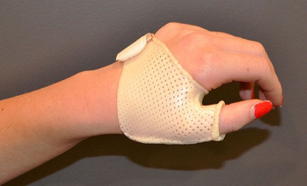 Main portant une attelle de pouce blanche avec un motif de doigt ouvert sur fond gris
