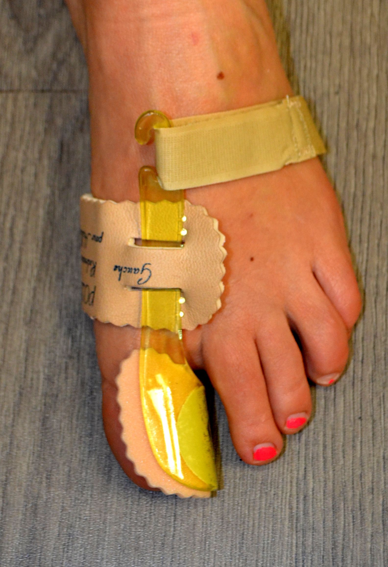 Main avec une attelle de poignet beige et une attelle jaune immobilisant le pouce et l'index