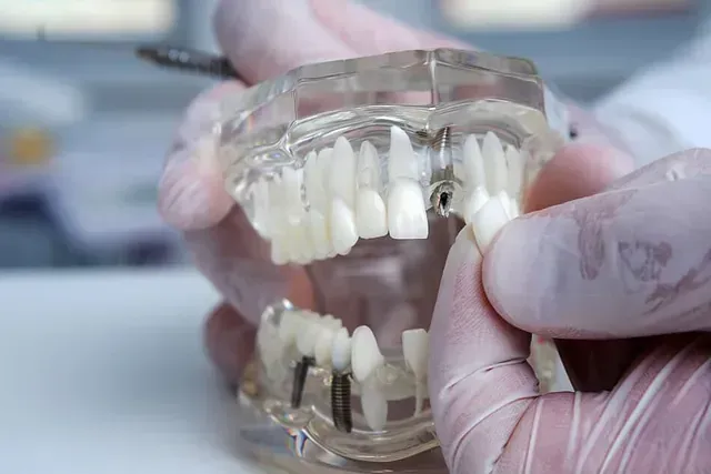 Un dentista sostiene un modelo de los dientes de una persona.