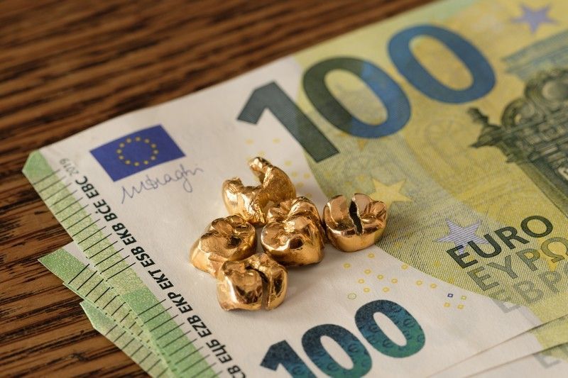 Zahngold auf 100-Euro-Scheinen – fairer Goldankauf in Basel beim Edelmetallhandel Keskin