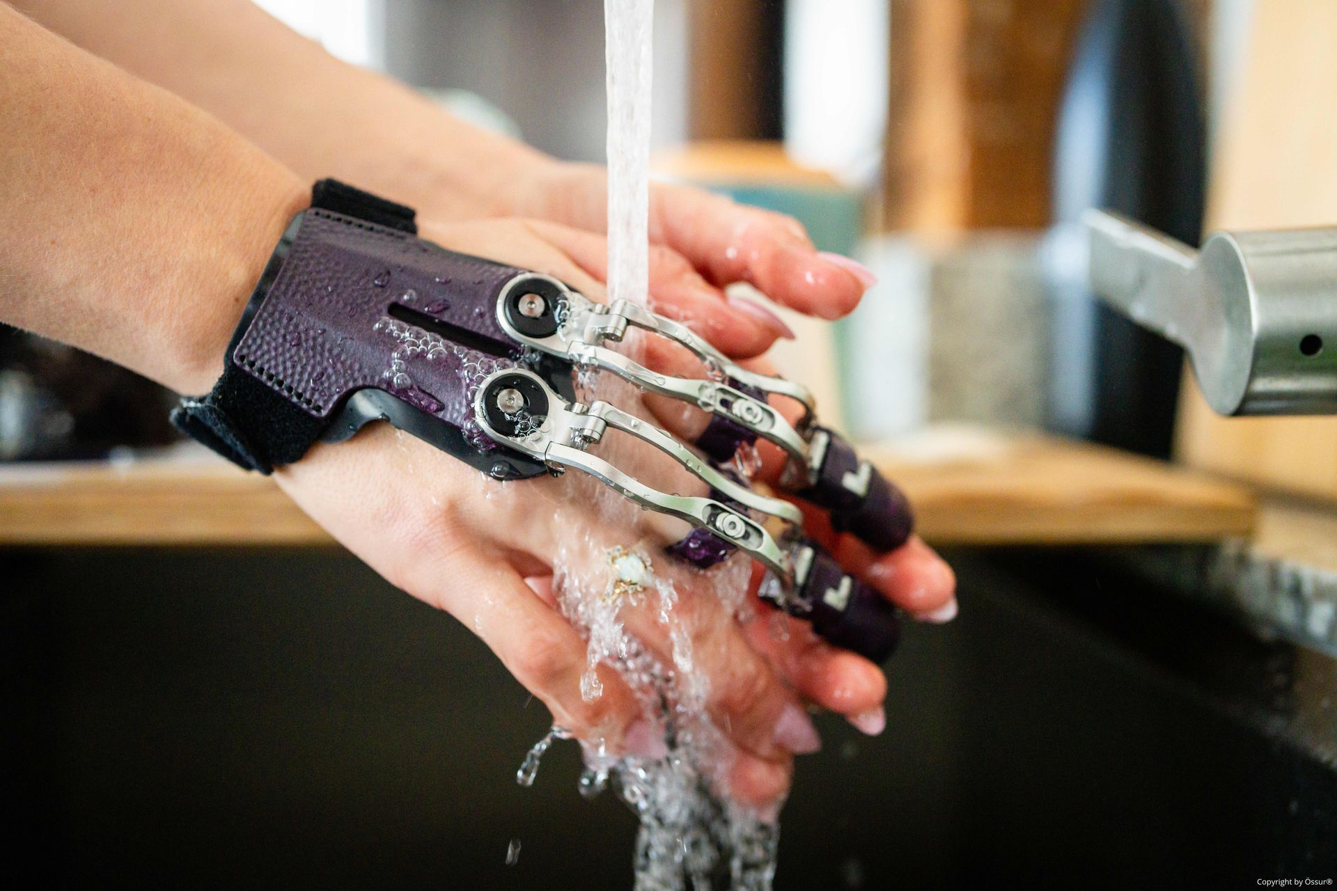 Eine Frau mit Fingerprothesen wäscht sich ihre Hände