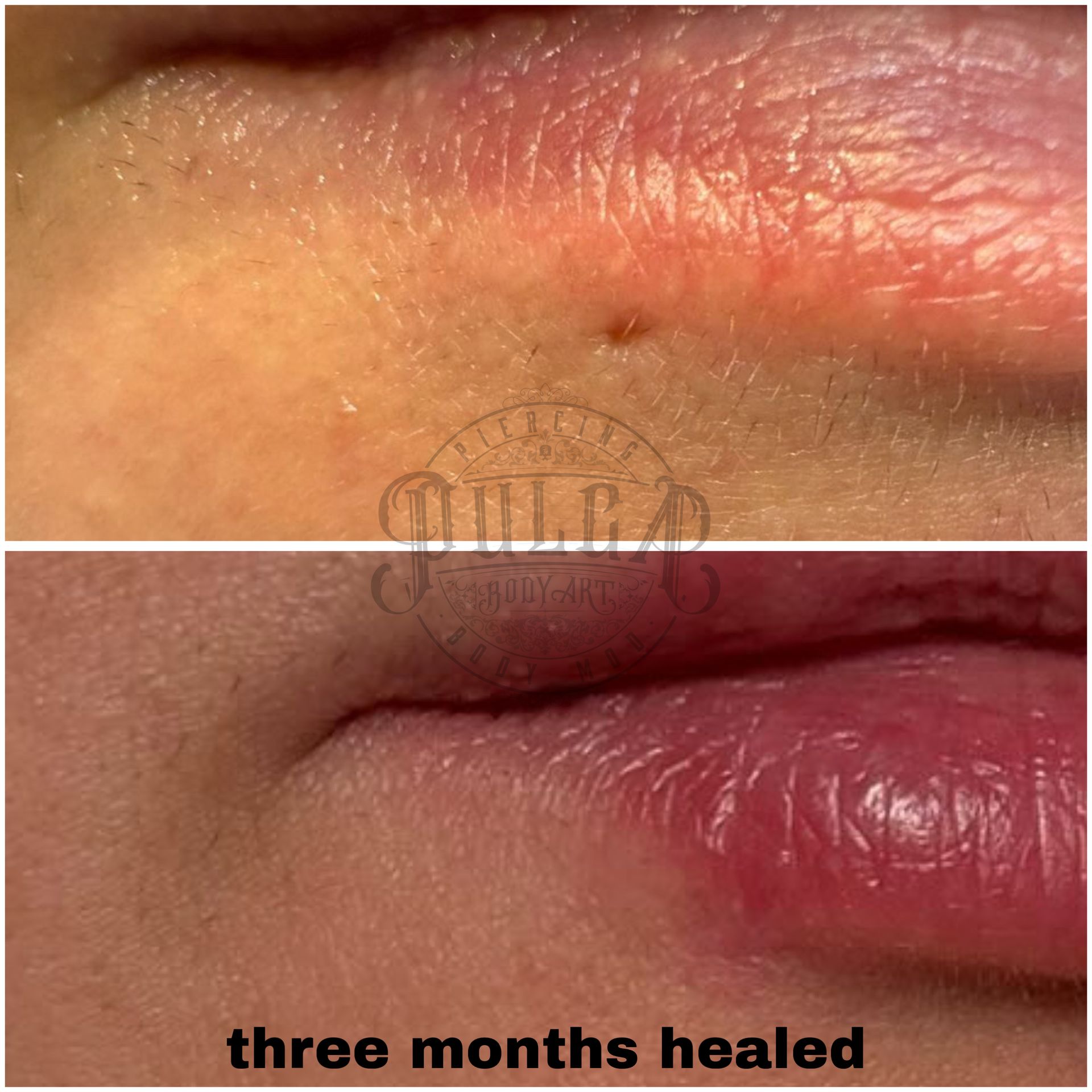 Primer plano de la nariz y la boca de una persona con múltiples perforaciones: fosa nasal, tabique y labio.