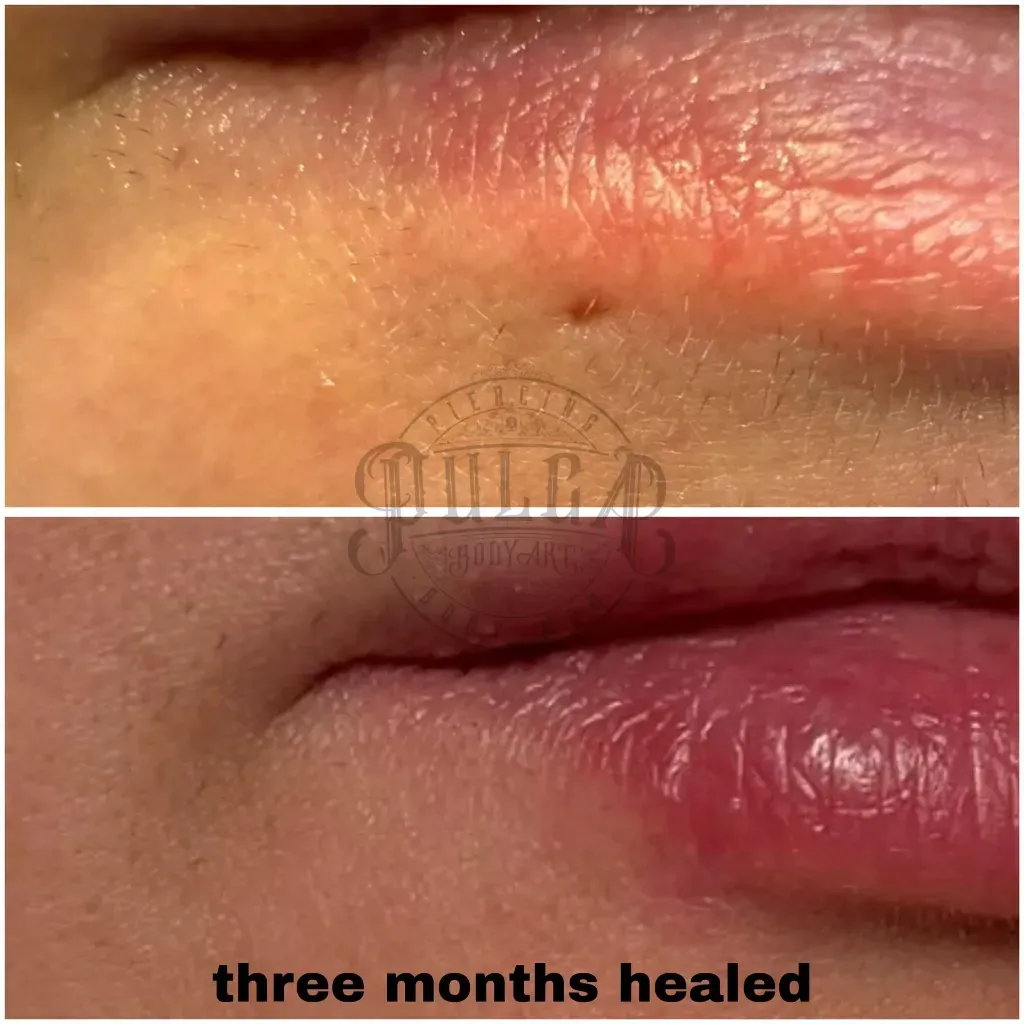 Primer plano de la nariz y la boca de una persona con múltiples perforaciones: fosa nasal, tabique y labio.