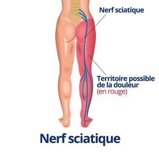Massage des jambes et nerf sciatique