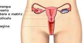 Problemas con la menstruación