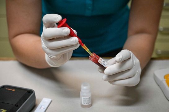 Analyse der Blutchemie im Labor der Pferdeklinik Moosweid