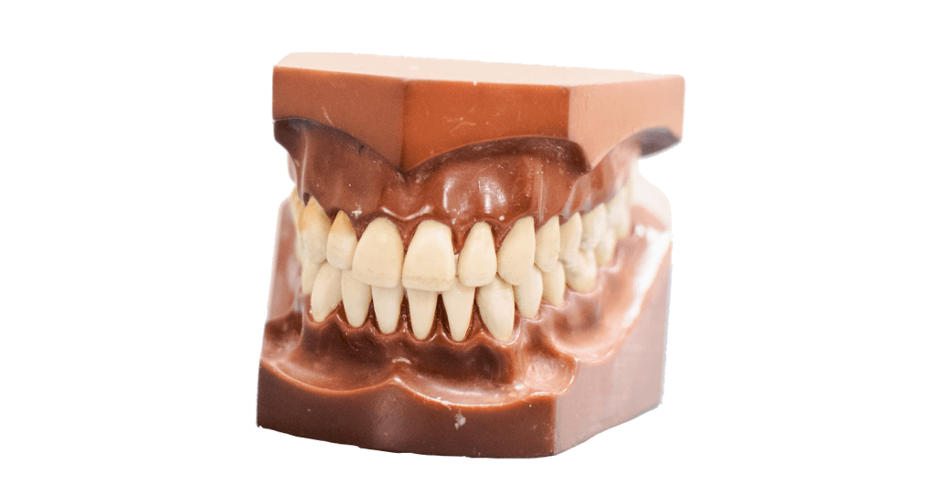 Modelo dental que muestra los dientes superiores e inferiores; dientes de color canela, encías marrones, colocados en una base marrón.